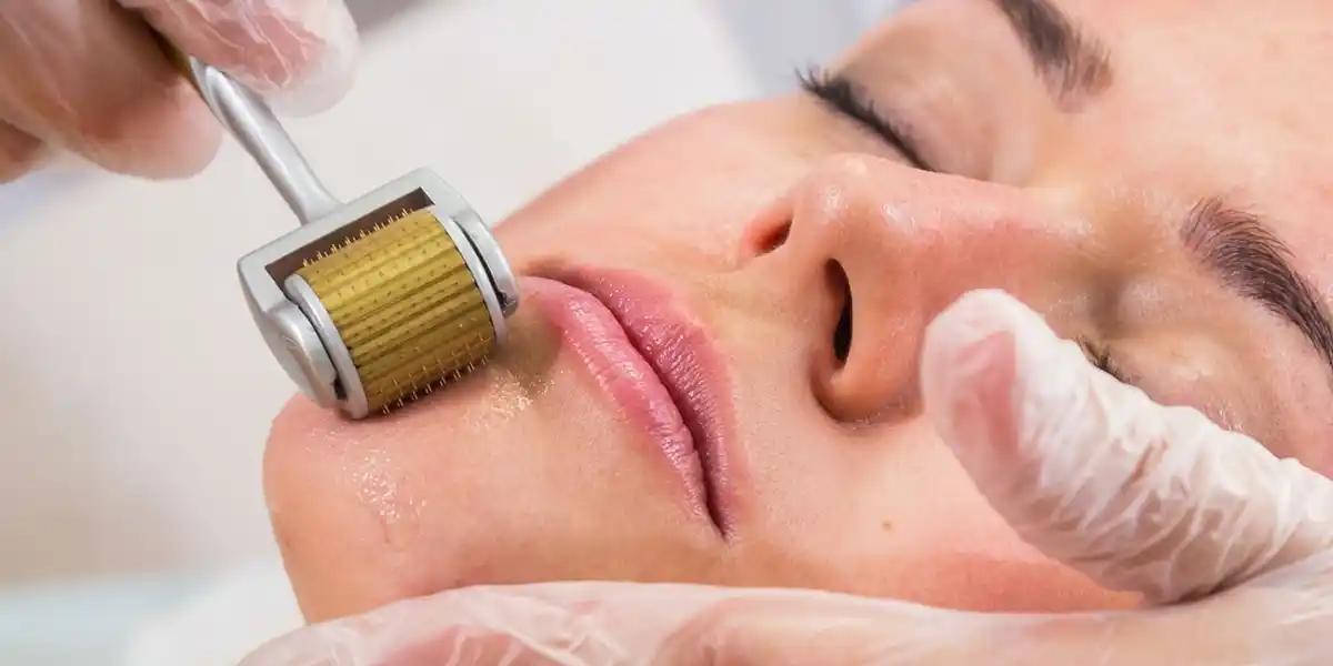 Derma Roller