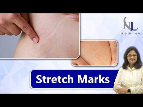 Dr. Nidhi Jindal skin-care video