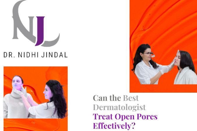 Can the Best Dermatologist Treat Open Pores Effectively?   loading=